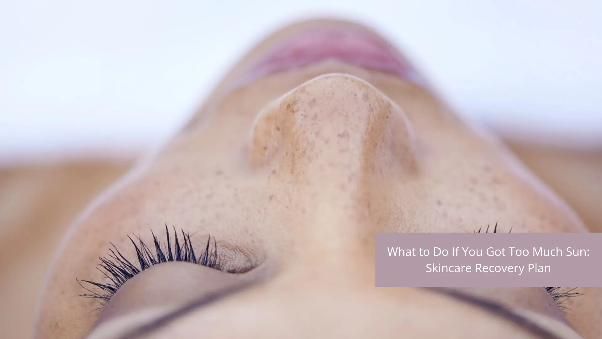 What to Do If You Got Too Much Sun: Skincare Recovery Plan